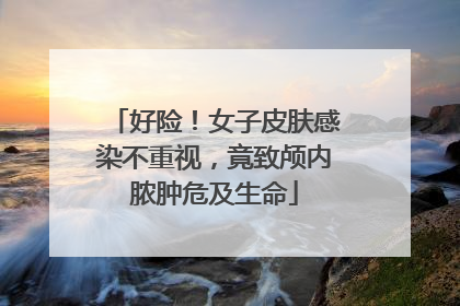好险！女子皮肤感染不重视，竟致颅内脓肿危及生命